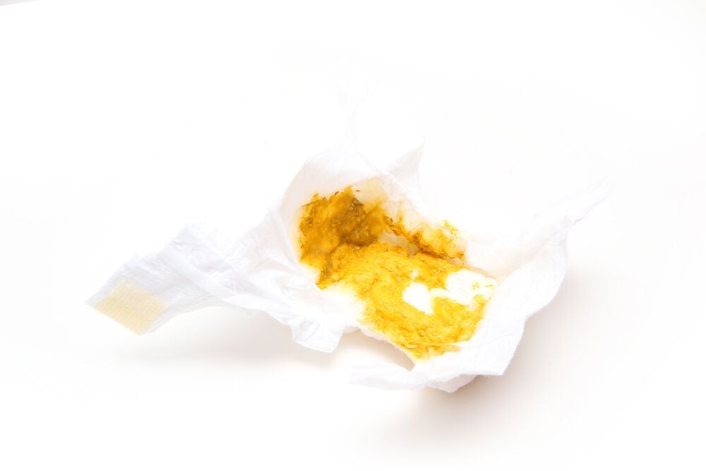 新生儿有黄色粘液: 正常还是异常?