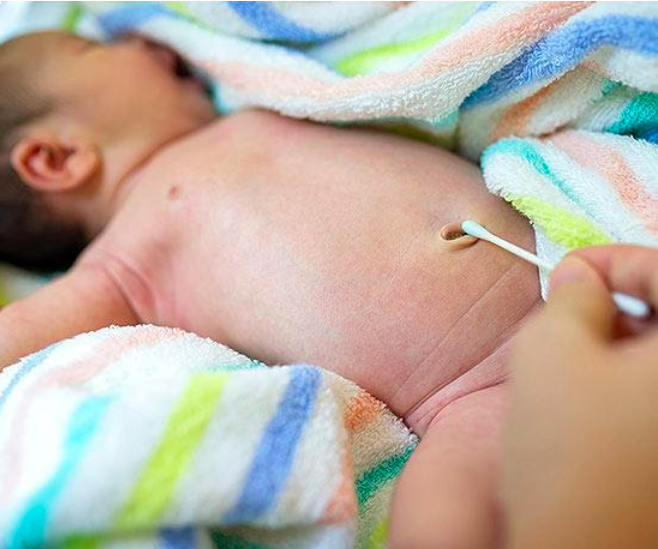 新生儿脱落后肚脐湿了,有异味妈妈要注意