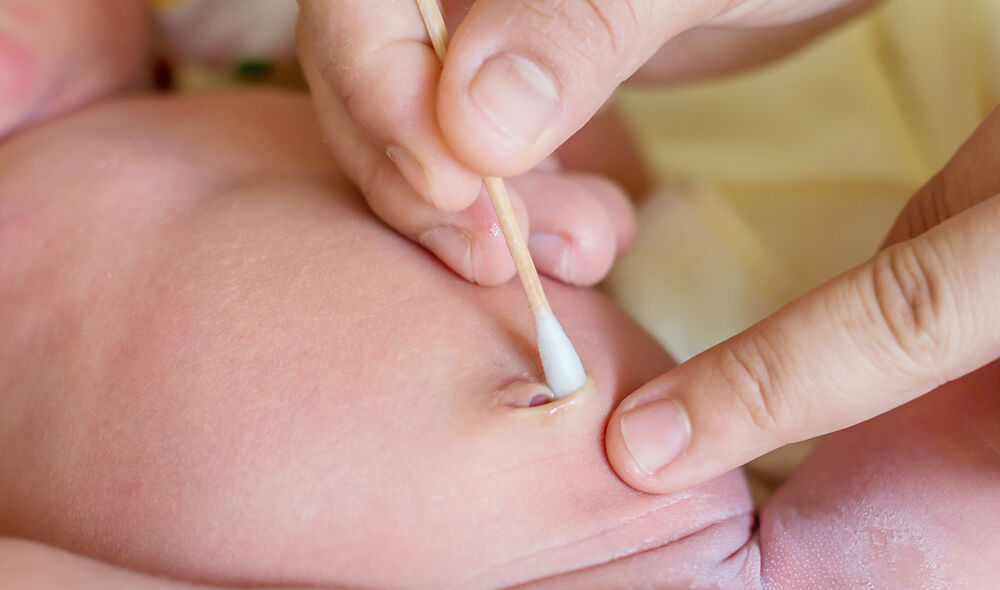 新生儿脱落后肚脐湿了,有异味妈妈要注意