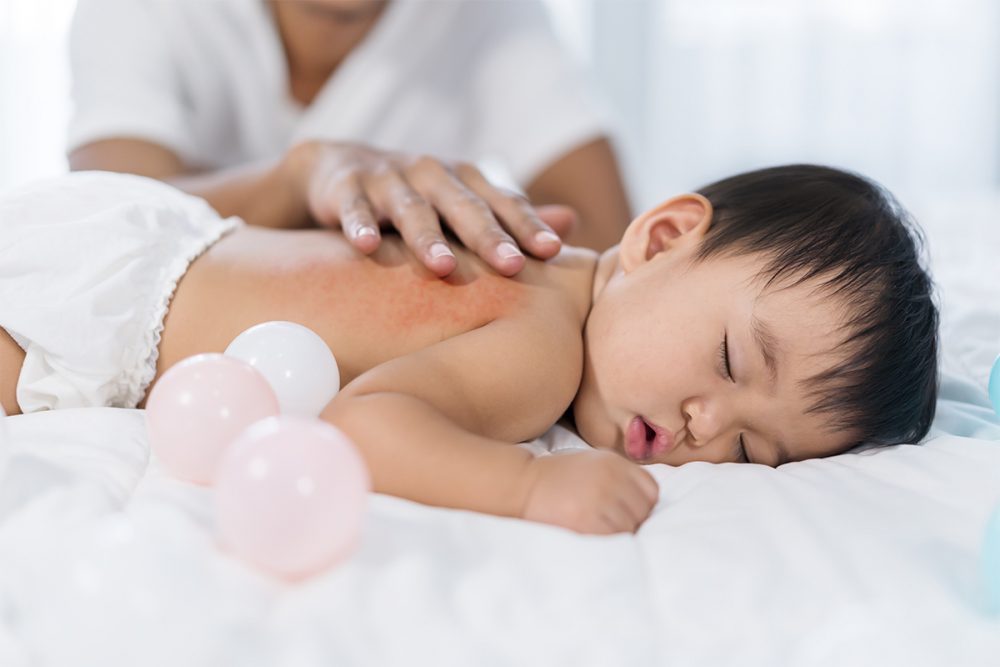 尿布会让宝宝大汗淋漓吗?