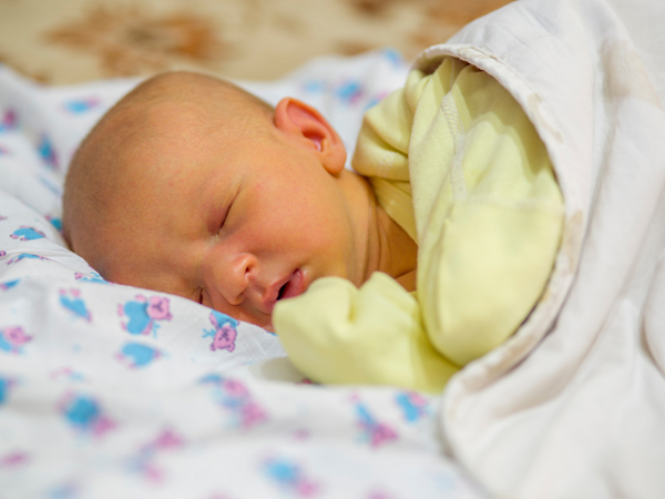 什么是胆红素,如何影响婴儿的健康?