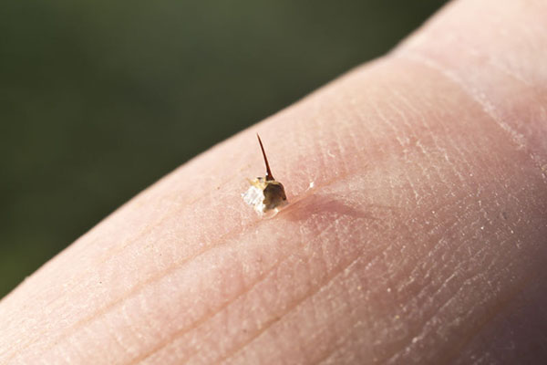 儿童过敏性休克,母亲需要高度警惕的危险状况!