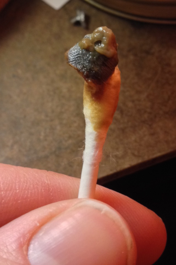 或多或少的耳垢,变色警告儿童的健康状况