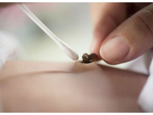 脱落后的肚脐护理: 妈妈需要知道的6个简单步骤!