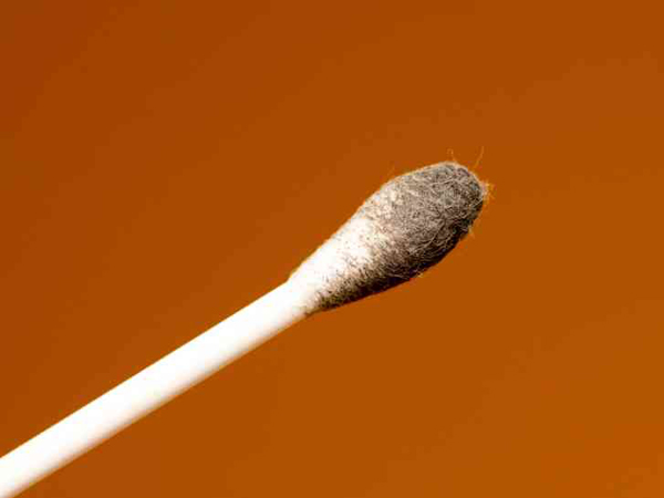 或多或少的耳垢,变色警告儿童的健康状况