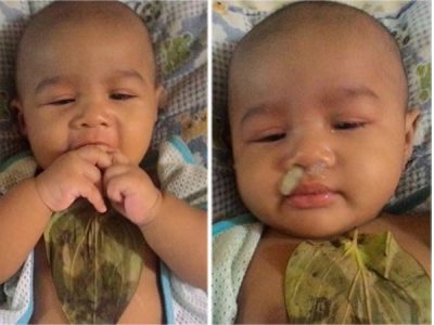 通过民间方法对婴儿有效和安全的流鼻涕治疗