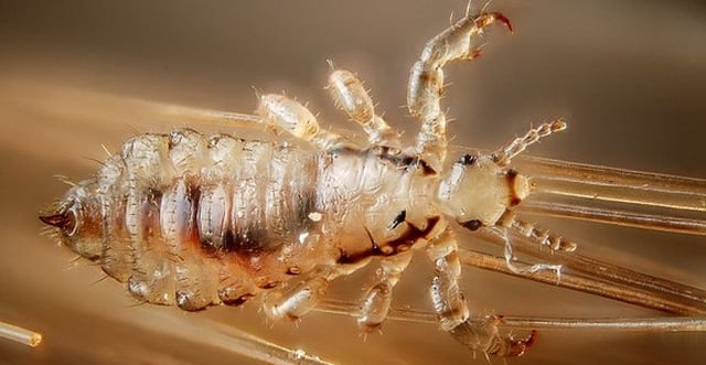 小学生通过日常接触更容易从同学那里传播虱子