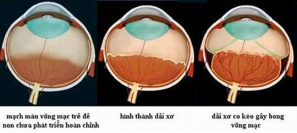 儿童常见眼病及治疗方法