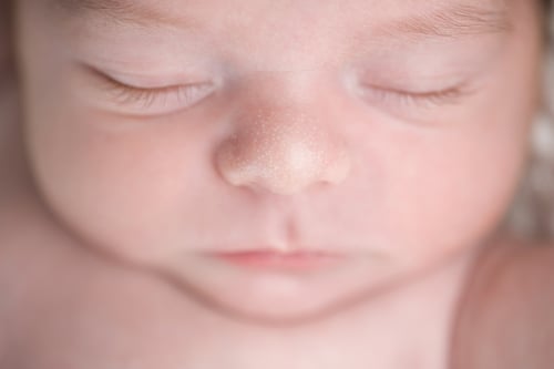 宝宝脸上红疹是怎么回事?原因和治疗