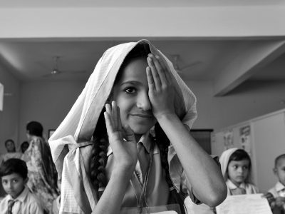 斜视: 治疗和误解