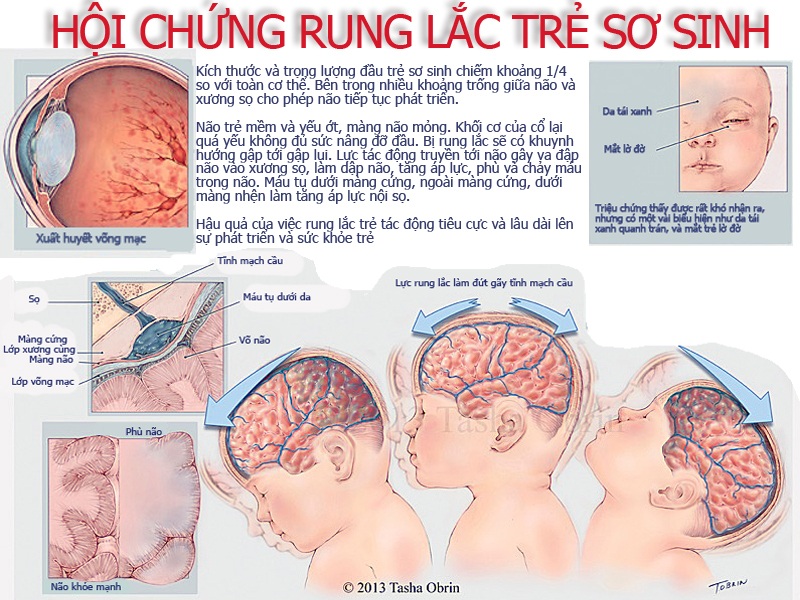 如果看到这些图像,妈妈将不敢摇晃婴儿