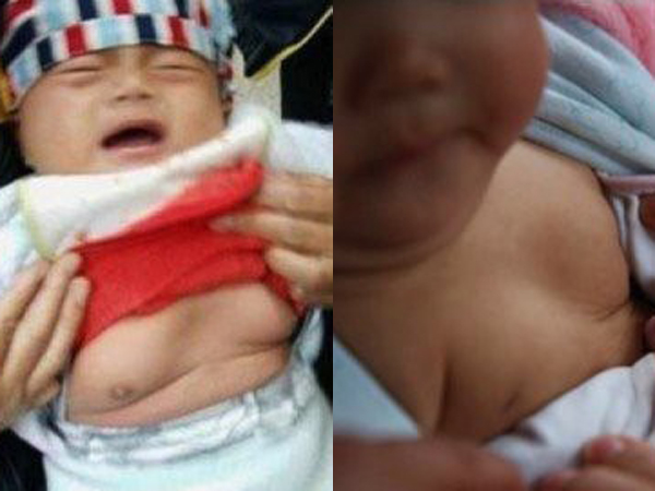 选择牛奶和儿童性早熟的风险