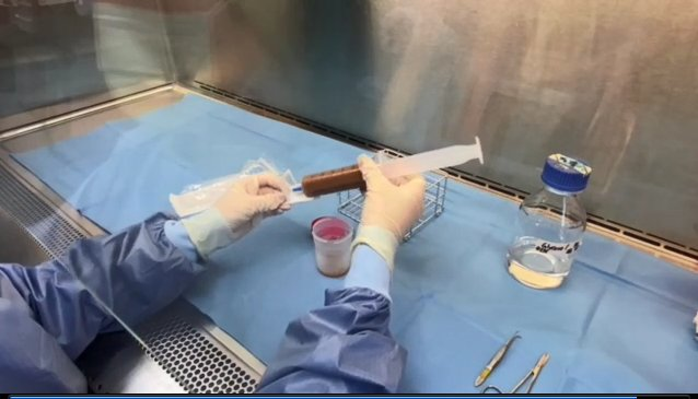 3岁童一天拉十几次、出现血便、体重减轻，确诊「困难梭菌感染」