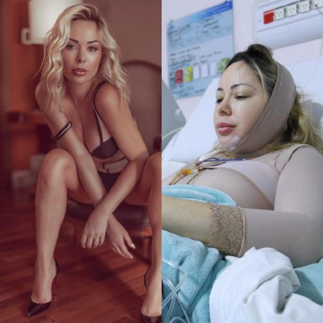 整形50次！巴西模特儿豪掷8百多万台币「当新女人」