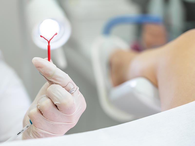 42岁女放避孕器放10年却怀孕，宝宝把它踢开了装上避孕器仍有5%怀孕可能！