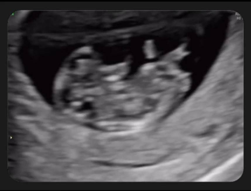 姐姐的朋友吴姗儒晒超音波画面宣布怀孕宪哥「要当阿公了」这样说