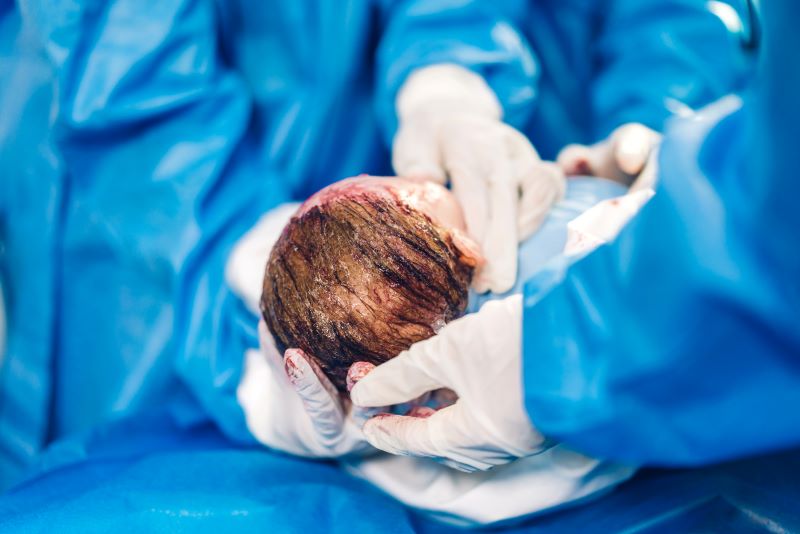 剖腹产事先知产期，可降低不安感，提早了解3件事，做好万全准备