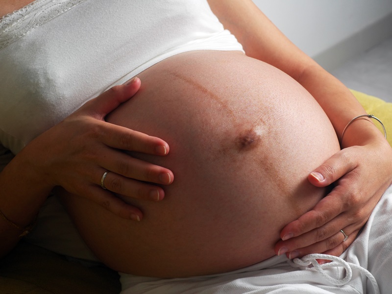 姙娠纹没救了吗？靠医美疗程行不行？类固醇、磨皮、肉毒杆菌、填充注射、雷