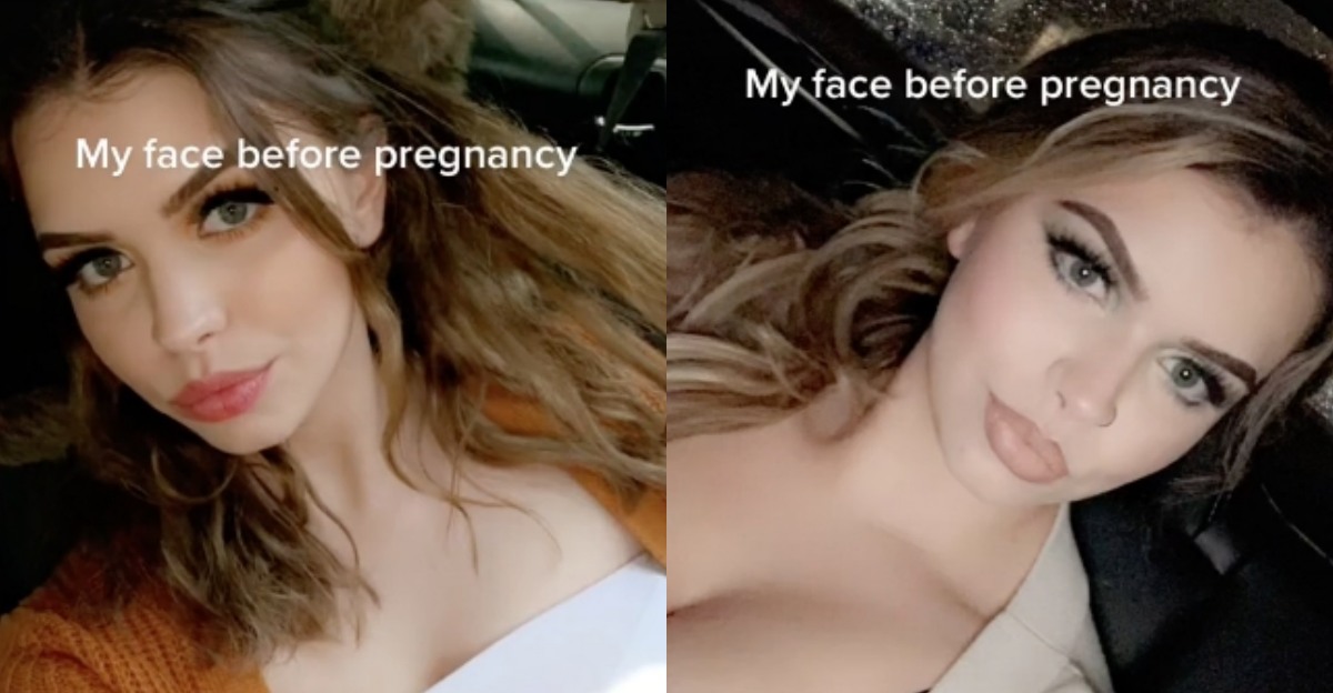 正妹因「怀孕水肿」判若两人！懒人式6招，有效改善孕期水肿！