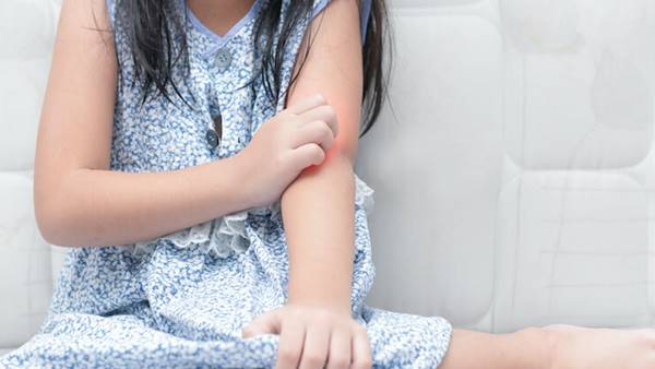 孩子被蚊虫叮咬处理5步骤，这动作能减少肿胀！伤口抓破后观察48hrs