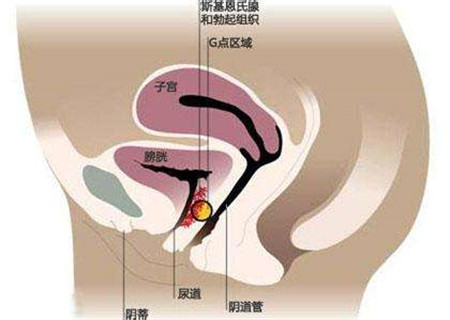 【女性G点在哪里】G点是女性的哪个位置_g点在哪个位置图