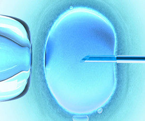 人工受孕并非人人适合，人工授精多少钱?