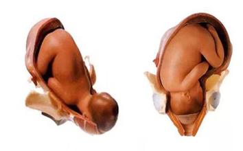 胎儿多少周入盆？胎儿入盆后多久会生