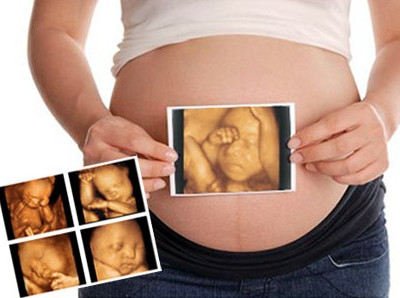 孕期做四维彩超的最佳时间?什么是三维彩超?四维彩超?