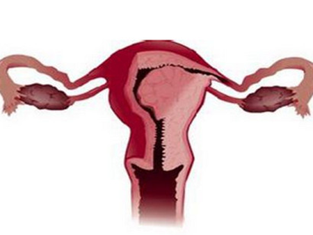 【前置胎盘什么原因造成的】前置胎盘是怎么造成的_前置胎盘是怎么形成的