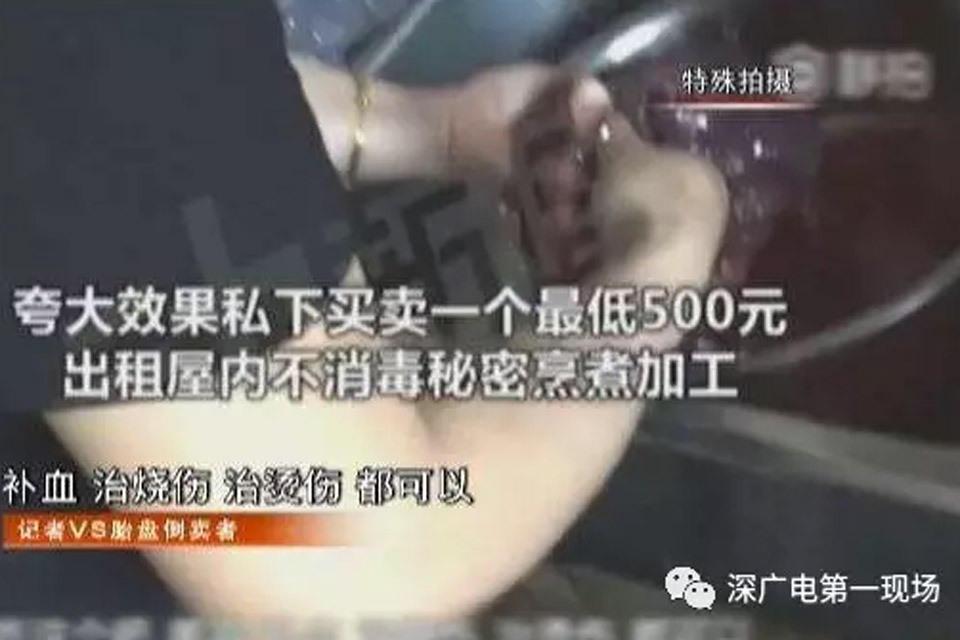 媒体曝深圳医院护工随意取走新生儿胎盘