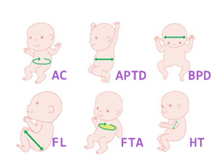 男孩双顶径一般是多少 双顶径看男女准吗