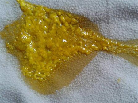 新生儿大便一天多少次正常，分为三种情况