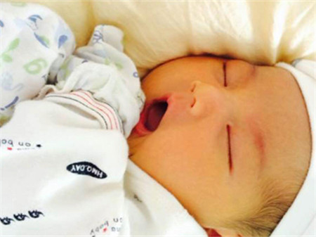 新生儿黄疸值对照表2 新生儿黄疸值对照表,新生儿黄疸值高怎么办?