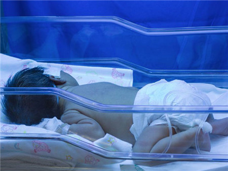 新生儿黄疸值对照表4 新生儿黄疸值对照表,新生儿黄疸值高怎么办?