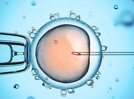 美国试管婴儿的优缺点7 美国试管婴儿有什么优缺点 美国试管婴儿的优势有哪些