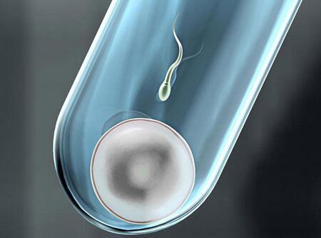 美国试管婴儿的流程图7 美国试管婴儿流程 美国试管婴儿的全过程