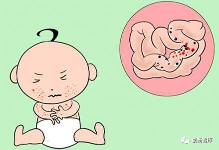 如何区分牛奶蛋白过敏和乳糖不耐受症？