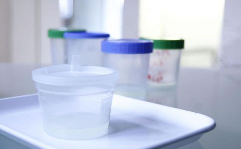 人工授精的具体步骤是什么 授精前该做哪些准备