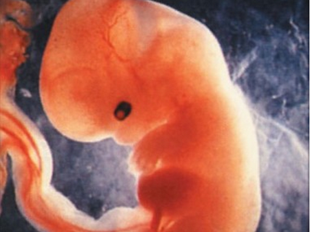 【怀孕5周】怀孕5周有什么反应_怀孕5周胎儿图