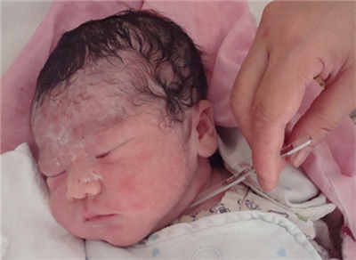 【胎脂】胎脂是什么_如何去处婴儿胎脂