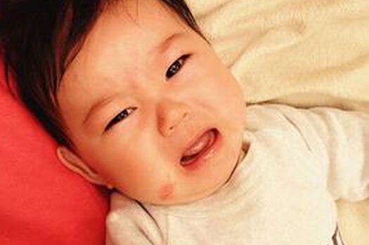 【宝宝食物过敏】婴儿食物过敏怎么处理_婴幼儿食物过敏怎么办