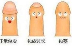 包皮,到底要不要割？