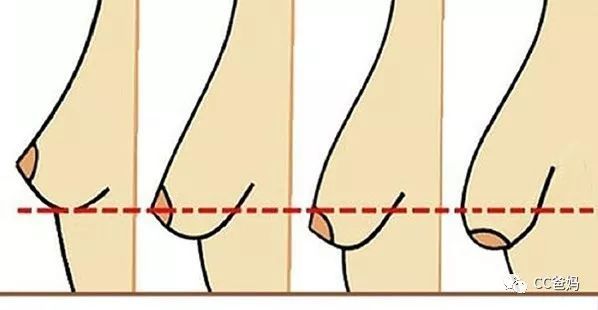 喂奶之后乳房真的下垂了？别担心，还有救！