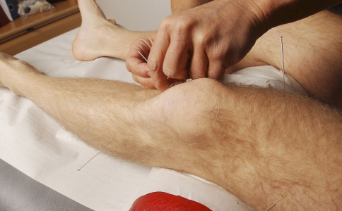 针灸和艾灸有什么区别 两者的功效是什么