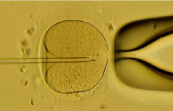 过来人自述人工受孕详细过程 从来就没这么尴尬过