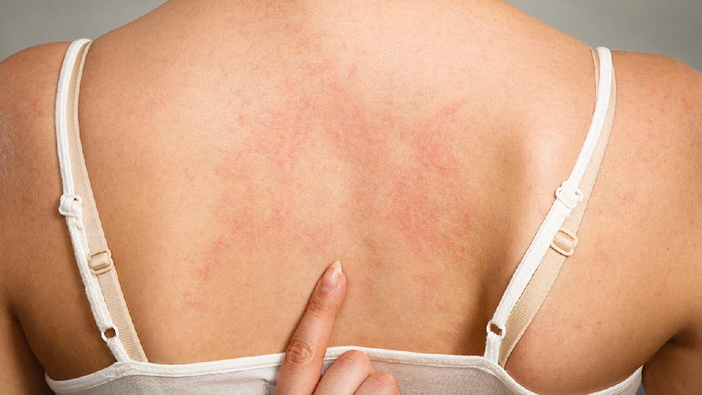 怎么预防艾滋病