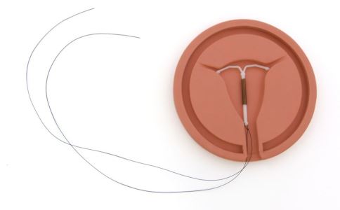 取环后不孕怎么办 建议女性这样做