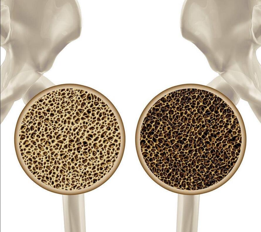 糖尿病能吃什么水果