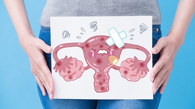 卵巢癌化疗后的不良反应有哪些