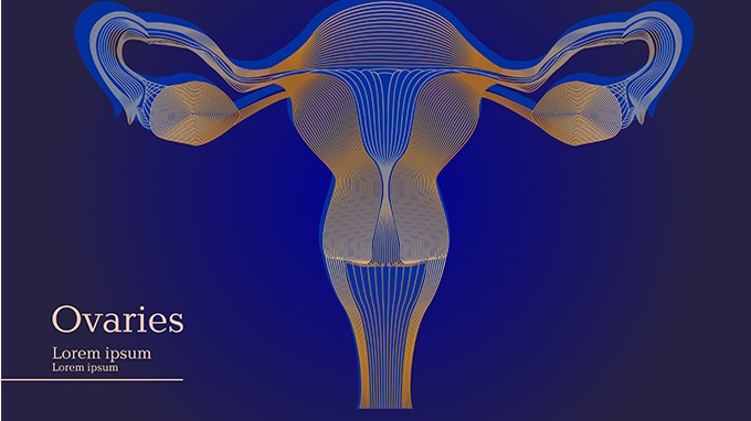 如何预防卵巢癌复发